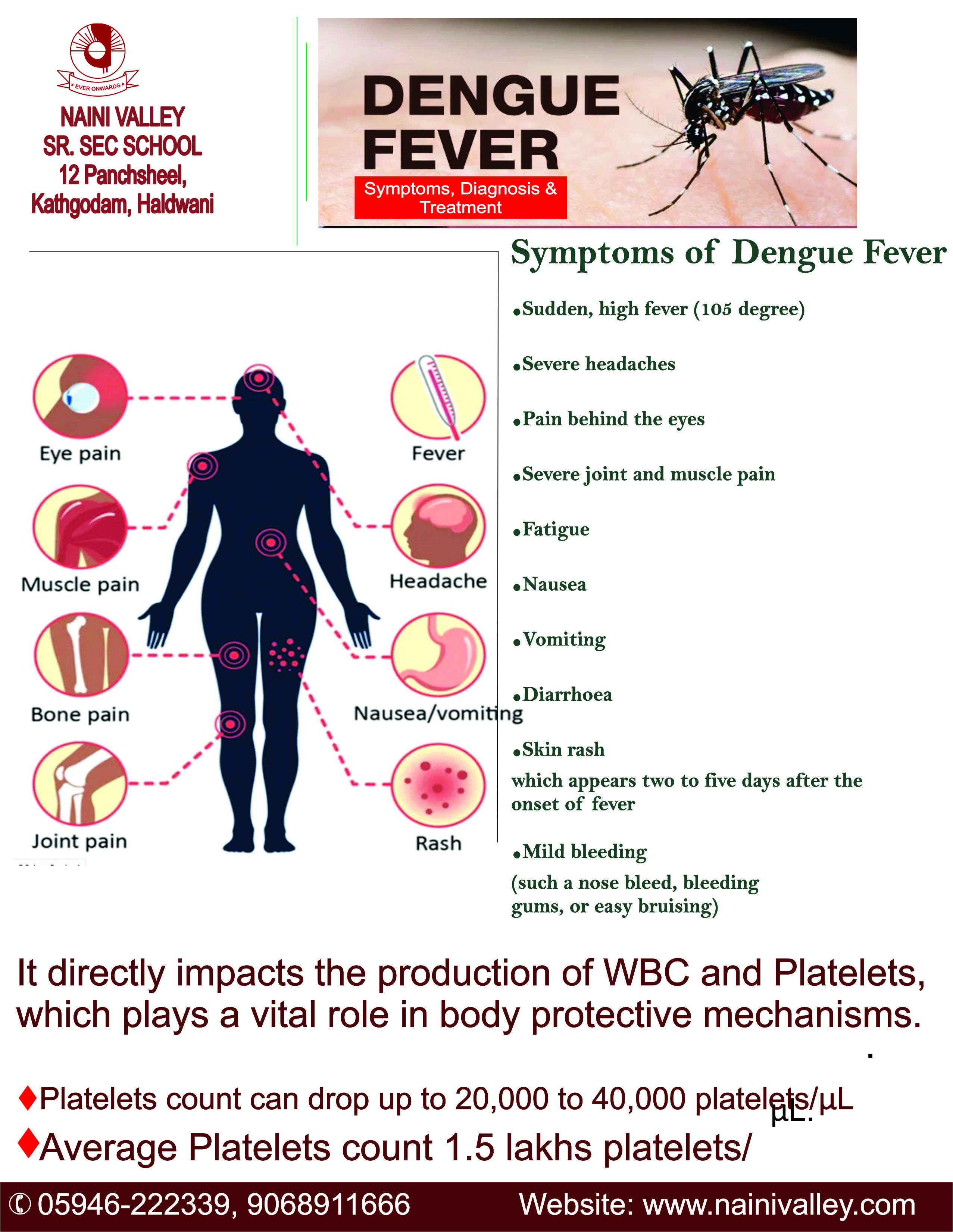 Symptoms of Dengue Dengue